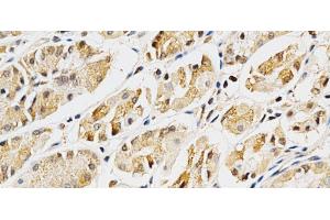 Immunohistochemistry of paraffin-embedded Human stomach using LGALS3 Polyclonal Antibody at dilution of 1:200 (40x lens). (Galectin 3 antibody)