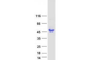 Validation with Western Blot (BCL7A Protein (Transcript Variant 2) (Myc-DYKDDDDK Tag))