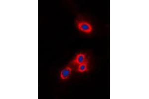 Immunofluorescent analysis of VAV2 staining in THP1 cells. (VAV2 antibody  (N-Term))
