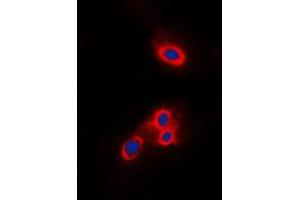 Immunofluorescent analysis of VAV2 staining in THP1 cells.