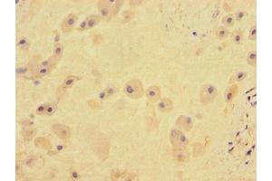Immunohistochemistry of paraffin-embedded human placenta tissue using ABIN7171961 at dilution of 1:100 (TGFBR2 antibody  (AA 25-159))