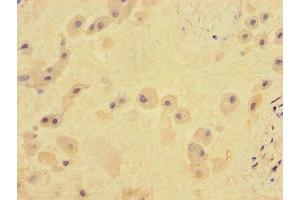 Immunohistochemistry of paraffin-embedded human placenta tissue using ABIN7171961 at dilution of 1:100