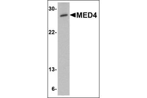 Western blot analysis of MED4 in human testis tissue lysate with this product at 0.