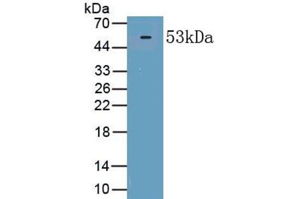 PINP anticorps  (AA 23-151)