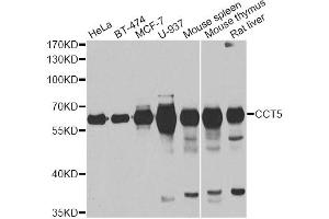 Western blot analysis of extracts of various cell lines, using CCT5 antibody (ABIN5973932) at 1/1000 dilution. (CCT5 antibody)