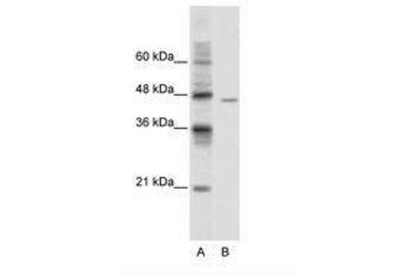 DDX25 antibody  (AA 355-404)