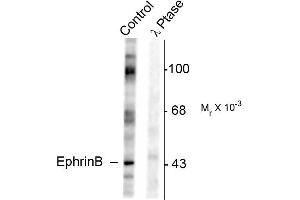 Western blots of rat testes lysate showing specific immunolabeling of the ~46k EphrinB phosphorylated at Tyr317 (Control). (EPH Receptor B2 antibody  (pTyr317))