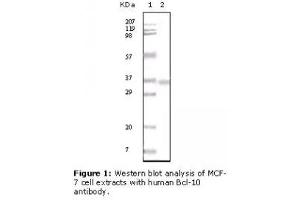 Image no. 2 for anti-B-Cell CLL/lymphoma 10 (BCL10) antibody (ABIN207592) (BCL10 antibody)