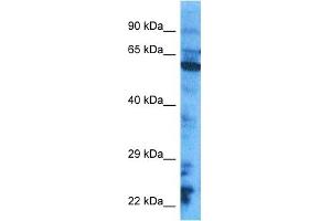 Host:  Rabbit  Target Name:  CY24B  Sample Tissue:  HepG2 Whole Cell lysates  Antibody Dilution:  1. (CYBB antibody  (C-Term))