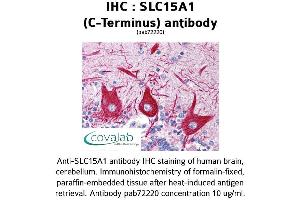 Image no. 1 for anti-Solute Carrier Family 15 (Oligopeptide Transporter), Member 1 (SLC15A1) antibody (ABIN1739331) (SLC15A1 antibody)