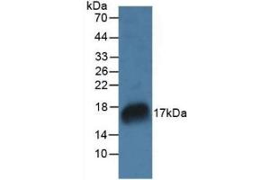 Detection of RNASE7 in Rat Marrow Tissue using Polyclonal Antibody to Ribonuclease A7 (RNASE7) (RNASE7 antibody  (AA 31-155))