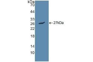 Detection of Recombinant LIPC, Human using Polyclonal Antibody to Lipase, Hepatic (LIPC) (LIPC antibody  (AA 25-247))