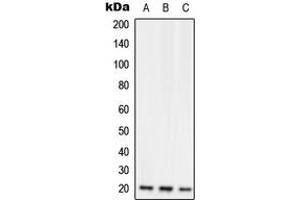 Western blot analysis of RGS10 expression in Jurkat (A), Raw264.