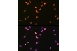 Immunofluorescence analysis of NIH-3T3 cells using DHX9/DHX9/RNA Helicase A Rabbit mAb (ABIN7265747) at dilution of 1:100 (40x lens). (DHX9 antibody)