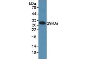 Detection of Recombinant MMP25, Human using Polyclonal Antibody to Matrix Metalloproteinase 25 (MMP25) (MMP25 antibody  (AA 108-313))