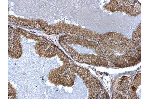 IHC-P Image TTC11 antibody detects TTC11 protein at mitochondria on mouse prostate by immunohistochemical analysis. (Fission 1 antibody  (full length))