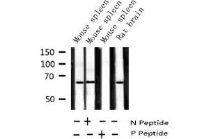 Western blot analysis of Phospho-NF kappaB p65 (Ser281) expression in various lysates (NF-kB p65 antibody  (pSer281))
