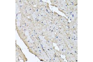 Immunohistochemistry of paraffin-embedded rat heart using USH1C antibody. (USH1C antibody  (AA 1-100))