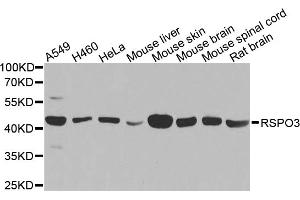 Western blot analysis of extracts of various cell lines, using RSPO3 antibody. (R-Spondin 3 antibody)