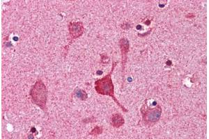 Human Brain, Cortex: Formalin-Fixed, Paraffin-Embedded (FFPE) (CCNDBP1 antibody  (AA 348-360))