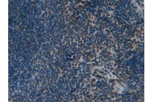 DAB staining on IHC-P; Samples: Mouse Spleen Tissue