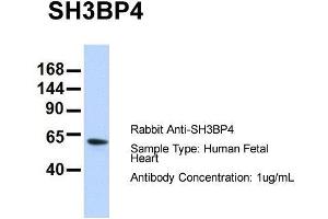 Host: Rabbit  Target Name: SH3BP4  Sample Tissue: Human Fetal Heart  Antibody Dilution: 1.