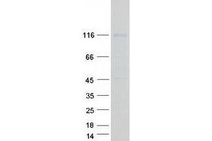 Validation with Western Blot (PML Protein (Transcript Variant 9) (Myc-DYKDDDDK Tag))