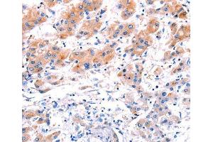 Immunohistochemistry (IHC) image for anti-C-Type Lectin Domain Family 4, Member D (CLEC4D) (AA 39-215) antibody (ABIN6219759) (CLEC4D antibody  (AA 39-215))