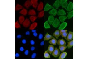 ABIN6257057 and ABIN6274550 staining Hela cells(45 min of heat-shock) by IF/ICC. (CHKB antibody  (C-Term))