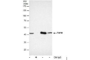 IP Image Immunoprecipitation of TUFM protein from HepG2 whole cell extracts using 5 μg of TUFM antibody , or TUFM antibody, Western blot analysis was performed using TUFM antibody, EasyBlot anti-Rabbit IgG  was used as a secondary reagent.