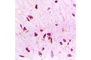 Immunohistochemical analysis of BAF53B staining in human brain formalin fixed paraffin embedded tissue section. (Actin-Like 6B antibody)