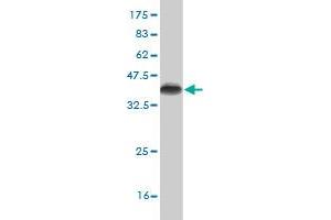 Western Blot detection against Immunogen (35. (CDK4 antibody  (AA 211-303))