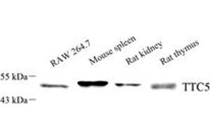 Western blot analysis of TTC5 (ABIN7075874),at dilution of 1: 1000,Lane 1: RAW 264. (TTC5 antibody)