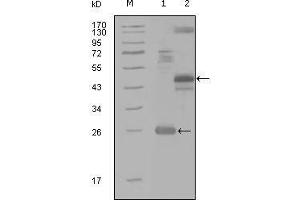 Western blot analysis using MAP4K4 mouse mAb against truncated Trx-MAP4K4 recombinant protein (1), MBP-MAP4K4 (aa300-400) recombinant protein (2) and MAP4K4(aa194-436)-hIgGFc transfected CH0-K1 cell lysate(3). (MAP4K4 antibody  (AA 400-500))