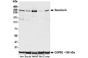Western Blotting (WB) image for anti-Senataxin (SETX) (AA 900-950) antibody (ABIN7453328)