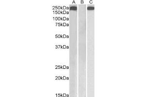 HEK293 lysate (10ug protein in RIPA buffer) overexpressing Human THBS1 with C-terminal MYC tag probed with ABIN2560404 (1ug/ml) in Lane A and probed with anti-MYC Tag (1/1000) in lane C.