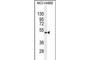 Western blot analysis in NCI-H460 cell line lysates (35ug/lane). (FNDC8 antibody  (AA 204-232))