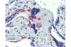 Anti-ZNF71 antibody IHC staining of human placenta. (ZNF71 antibody  (Middle Region))