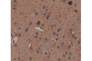 Figure. (IL20RA antibody  (AA 268-538))