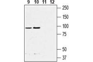 Western blot analysis of rat (lanes 9 and 11)  and mouse (lanes 10 and 12)  fat tissue lysate: - 9, 10. (F4/80 antibody  (Extracellular, N-Term))