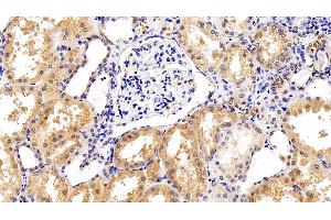 Immunohistochemistry (IHC) image for anti-Interleukin 6 Signal Transducer (Gp130, Oncostatin M Receptor) (IL6ST) (AA 392-566) antibody (ABIN7430552)
