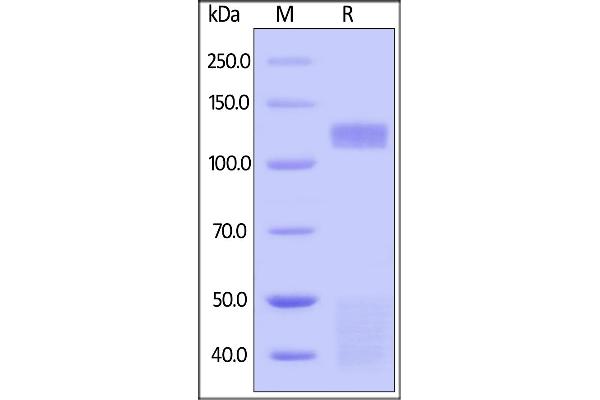 Insulin Receptor Protein (INSR) (AA 28-944) (His tag)