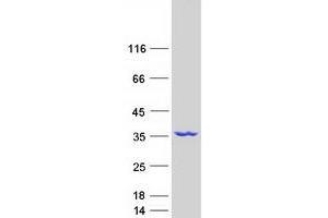 Validation with Western Blot (NMRAL1 Protein (Myc-DYKDDDDK Tag))