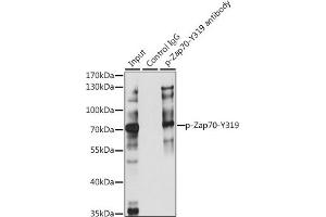 Immunoprecipitation analysis of 200 μg extracts of Jurkat cells, using 3 μg Phospho-Z-Y319 pAb (ABIN3023645, ABIN3023646, ABIN3023647, ABIN1682143 and ABIN1682144). (ZAP70 antibody  (pTyr319))