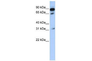 WB Suggested Anti-ABCD4 Antibody Titration:  0. (ABCD4 antibody  (N-Term))