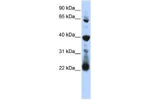 WB Suggested Anti-RPUSD3 Antibody Titration:  0. (RPUSD3 antibody  (Middle Region))