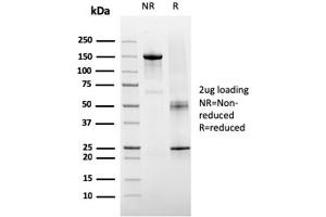 SDS-PAGE Analysis Purified TIGIT-Monospecific Mouse Monoclonal Antibody (TIGIT/3106). (TIGIT antibody  (AA 22-141))