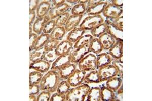 Formalin fixed and paraffin embedded human kidney tissue reacted with DEGS2 Antibody (C-term) followed by peroxidase conjugation of the secondary antibody and DAB staining. (DEGS2 antibody  (C-Term))