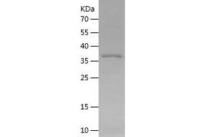 Western Blotting (WB) image for Cytochrome P450, Family 7, Subfamily B, Polypeptide 1 (CYP7B1) (AA 39-180) protein (His-IF2DI Tag) (ABIN7122584) (CYP7B1 Protein (AA 39-180) (His-IF2DI Tag))
