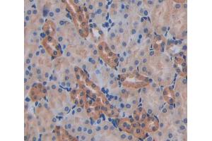 Used in DAB staining on fromalin fixed paraffin- embedded kidney tissue (AFAP antibody  (AA 352-572))